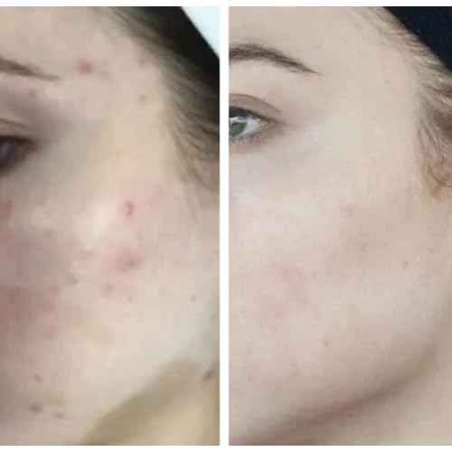HigherDOSE Light-Activated GLOW SERUM - Anti Aging Face Serum to Plump, Hydrate & Smooth Fine Lines - Made with Vitamin C, Copper Peptides & Hyaluronic Acid - Boosts Benefits of Red Light (1 oz)