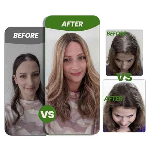 HAIR 14 Inch Hair Toppers for Women Real Human Hair Natural Black color 150 Density 6x7inch Silk Base 65 grams All Remy Human Hair Wiglets Hairpieces for Thinning Hair (#1B 14inch)