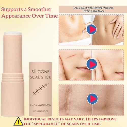 Scar Solutions Silicone Scar Stick ? Lightweight Care Easy-to-Apply Silicone for Face and Body ? Gentle on All Skin Types & Sensitive Skin (0.2 OZ)