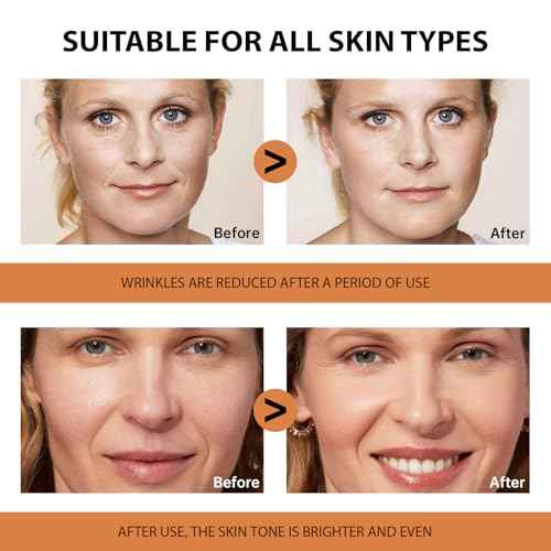 VGO Vitamin C Serum for Face, Vit C Anti Aging Serum with Hyaluronic Acid & Vitamina E, Deep Hydration Facial Care for All Skin Types, 1.01oz / 30ml