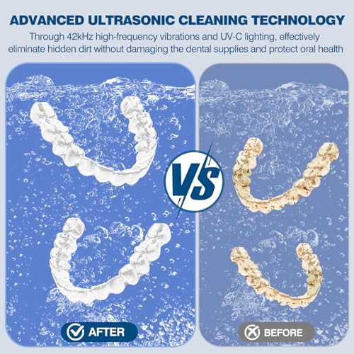 Dental Ultrasonic Retainer Cleaner Machine: 42KHz 28W 180ml,Dental Cleaning Pod for Dentures, Aligners & Mouthguards