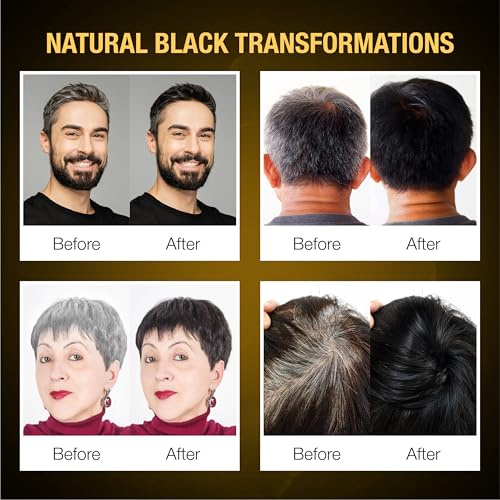 ABERA Hair Dye Shampoo, Black Hair Color for Grey Hair Coverage for Women and Men, One-wash Hair Blackening Treatment with Natural Dark Color (10.1 Fl. Oz.)