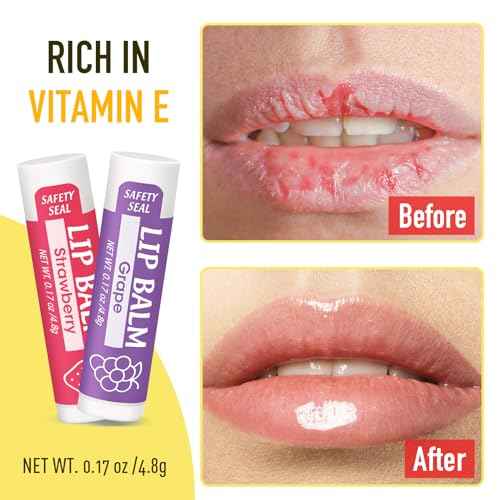 32 Pack Lip Balm, Natural Lip Balm Bulk with Vitamin E and Coconut Oil, Moisturizing Lip Balms for Dry Cracked Lips, Lip Balms for Stocking Stuffers - 8 Flavors
