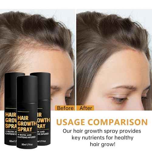 Halo Grow Hair Growth Spray, Hair Thickening Spray for Fine Hair, Volumizing & Moisturizing Treatment with Natural Ingredients, For Men & Women, 1.7 Fl Oz