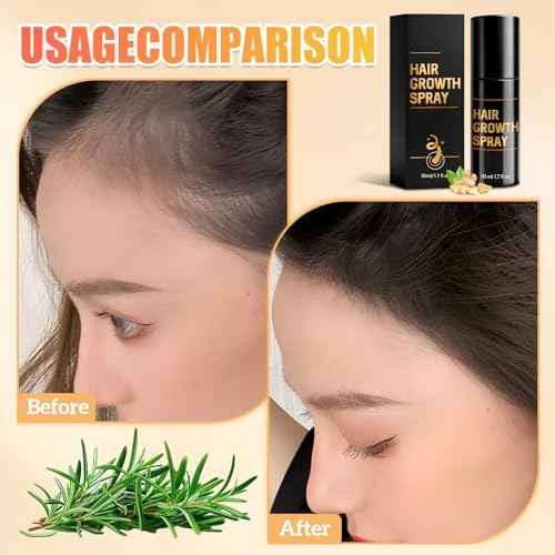 Hair Growth, Hair Growth Spray, Promotes Thicker, Fuller Hair, Suitable for All Hair Types, Hair Thickening Spray with Natural Ingredients (1 Count)