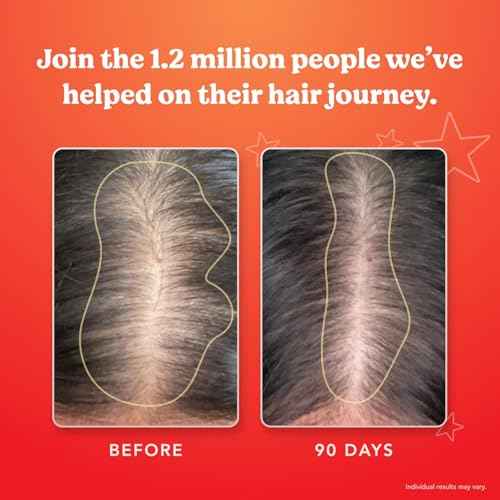 HAIRtamin Advanced Formula Hair Growth Supplement for Women & Men, Supports Stronger, Longer, Visibly Thicker Hair, With 5000 mcg Biotin, Vitamins & Antioxidants, 100% Vegan ? 3 Month Supply