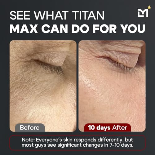 Titan MAX Anti-Aging Face Serum for Men ? Ultra Potency Mens Face Moisturizer ? Men, Dark Spots, Wrinkles, Fine Lines ? Vitamin C & E, 10% Niacinamide, Hyaluronic Acid ? Unscented