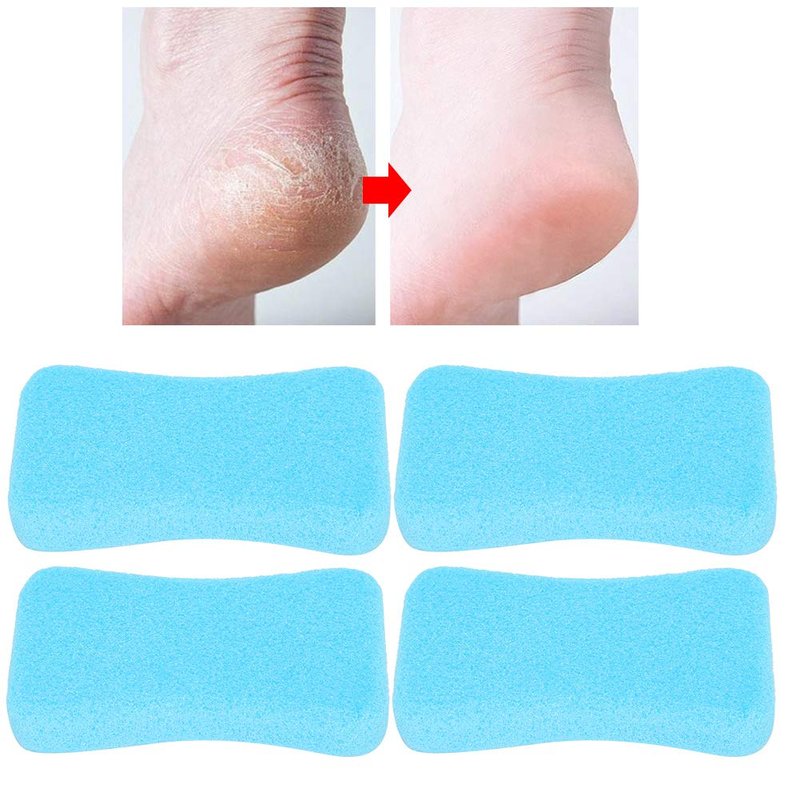 Foot Pumice Stone for Feet Hard Skin Callus Remover and Scrubber, Foot File Exfoliation to Remove Dead Skin (Pack of 4) (Blue)