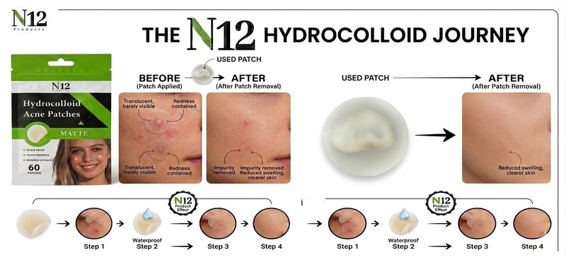 N12 Products-Best Hydrocolloid Acne Patch – Shrinks Zits and Whiteheads in One Use, Nighttime Pimple Spot Stickers for Face and Skin.