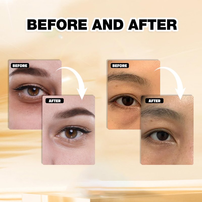 Gold Under Eye Masks - Collagen Hydrating Gel Patches for Dark Circles & Fine Lines | 24 Pairs Vegan, Cruelty-Free Skincare