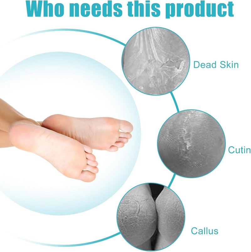 Callus Remover Foot File - 4 in 1 Pumice Stone & Scrubber for Home Foot Care | 2 Pcs Grey Set