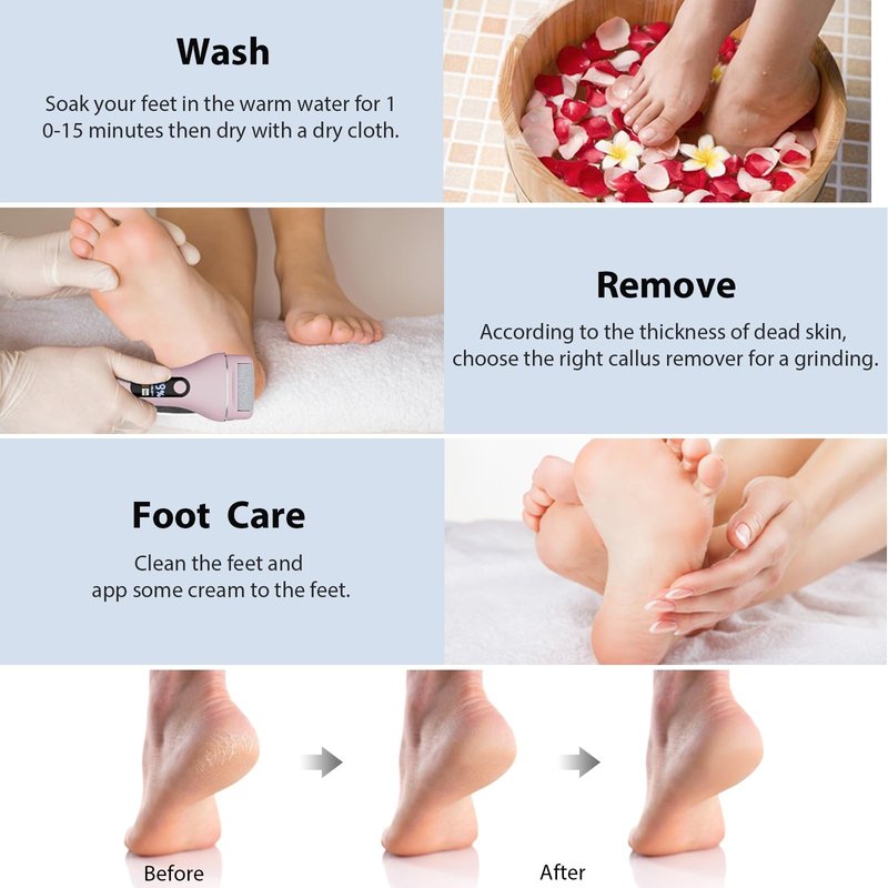 AdamPark Electric Callus Remover for Feet, Rechargeable Portable Electronic Foot Callus Remover 2-in-1 Wet/Dry Foot Scrubber Electric Toot File for Hard Cracked Dry Dead Skin(Pink)