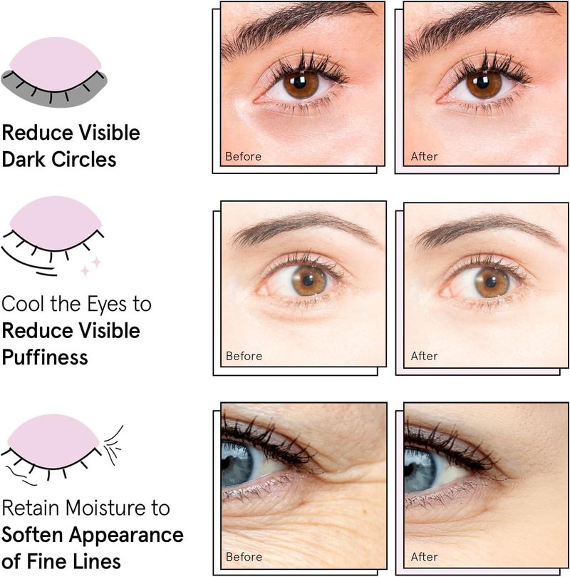grace & stella Award Winning Under Eye Mask Reduce Dark Circles, Puffy Eyes, Undereye Bags, Wrinkles, Gel Under Eye Patches, Small Gifts for Women, Gifts Under 10 Dollars, Vegan (6 Pairs, Blue)