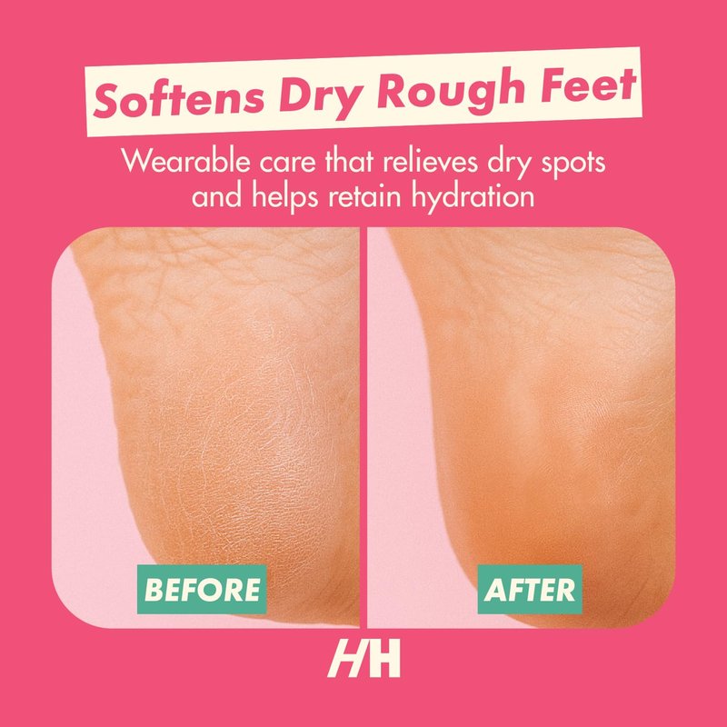 Handmade Heroes Foot Mask for Cracked Heel Treatment Gel Mask for Dry Cracked Feet Women with Jojoba & Vitamin E Intensive Overnight Heel Repair Moisturizing Overnight 2pc