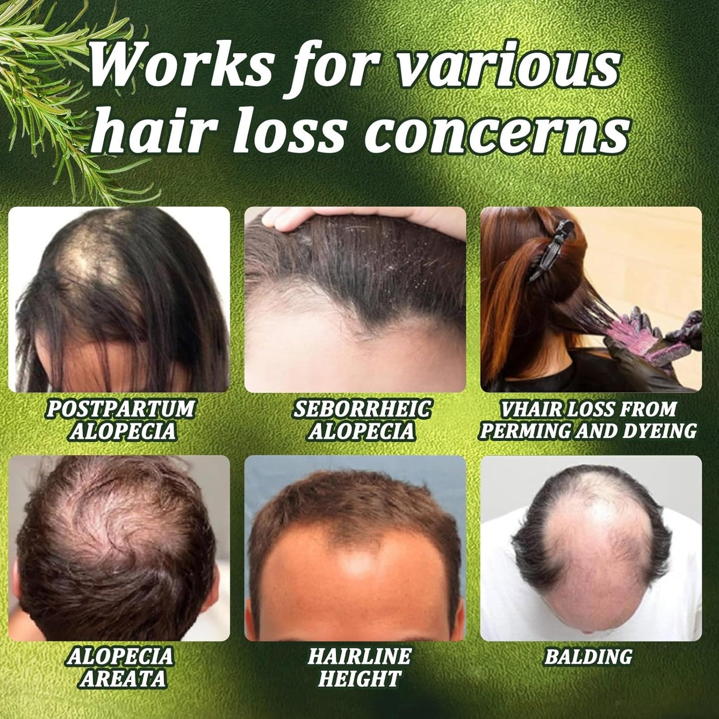 Skiennix Organic Rosemary Hair Growth Shampoo - Natural Thickening Formula with Biotin & Keratin | 10.15 fl. oz - 2 Pack