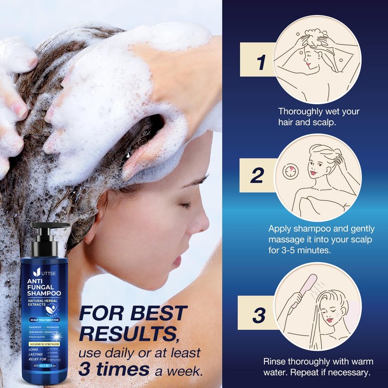 Uttse Anti-Fungal Shampoo for Scalp Psoriasis: Dandruff Shampoo for Folliculitis and Seborrheic Dermatitis - Relieves Itchy & Dry Scalp - 300 mL / 10.1 fl.oz