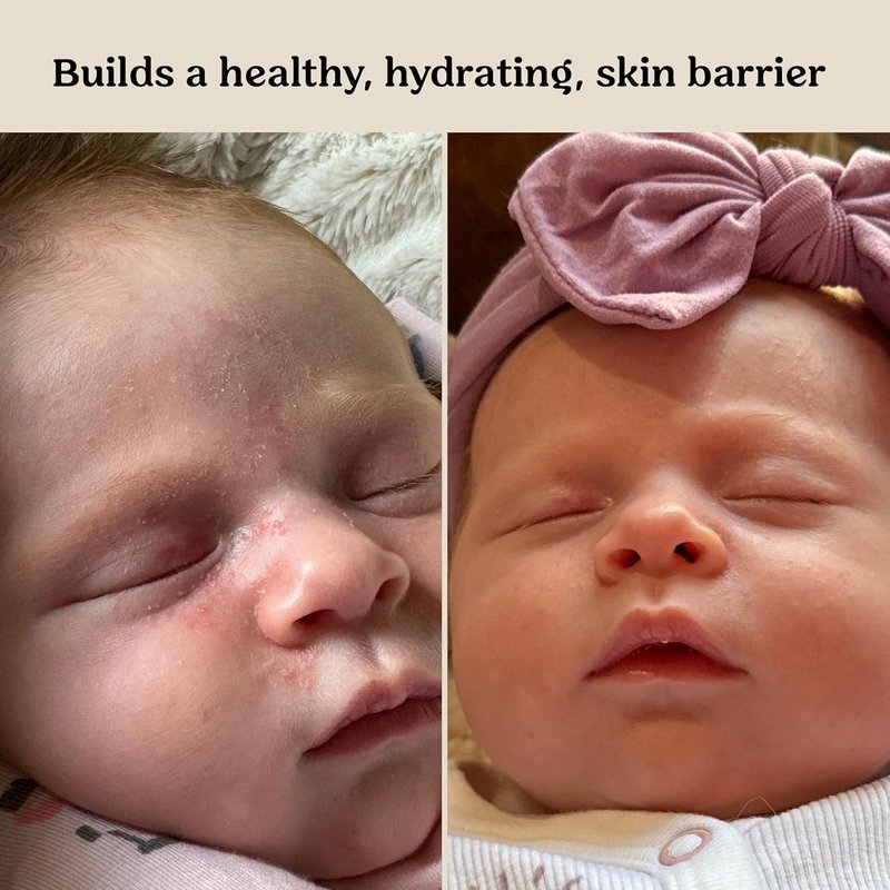 Roe Wellness Baby Cream & Serum Power Pair - Hydrating Skincare for All Ages | Body & Face Care for Toddlers & Newborns