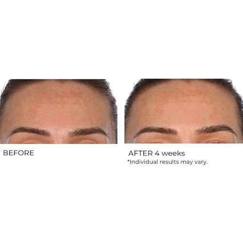 NassifMD Hydro-Gel with Hylauronic Acid Moisturizer, Salicylic Acid Serum, Retinol Serum for Face
