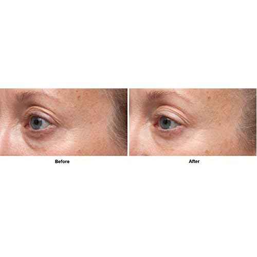 Dr Dennis Gross Ferulic + Retinol Triple Correction Eye Serum: for Wrinkles, Loss of Elasticity, and Rough Texture, 0.5 fl oz