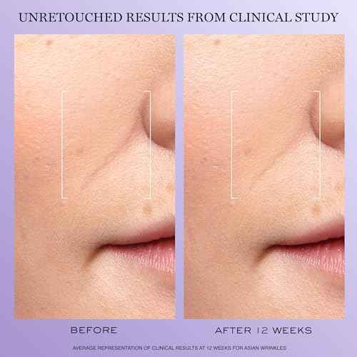 Lanc?me R?nergie H.C.F. Triple Serum - Hyaluronic Acid Serum for Visible Correction of Anti Aging Signs & Dark Spots - With Vitamin C+, Niacinamide & Ferulic Acid