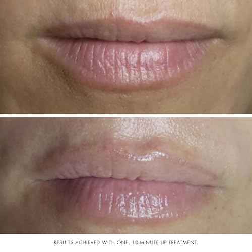 Bioelements Collagen Rehab - 1.7 fl oz - Face & Lip Mask for Aging Skin - Creates Instant Dewiness + Improves Fine Lines & Wrinkles - Vegan, Gluten Free - Never Tested on Animals