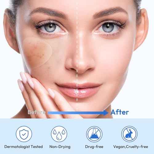 Full Face Pimple Patches(5 Pack),Big Hydrocolloid Acne Patches,Skin Care Zit Patches for Whole Face,Nose, Chin, Forehead & Cheeks w/Tea Tree Oil, Salicylic Acid & Cica Oil£¨5 Pack,25 Patches£©