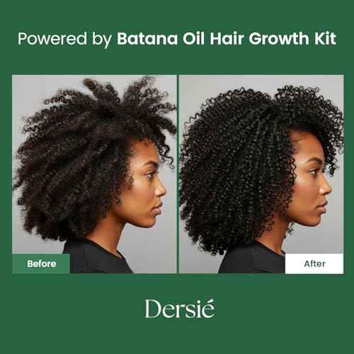 Dersie Batana Oil for Hair Growth Kit ? 100% Pure Batana Oil & Batana Shampoo Sourced from Honduras ? Promotes Hair Growth & Nourishes Scalp ? For Hair Loss, Thinning Hair, Dry, Damaged & Curly Hair