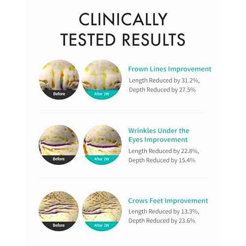 REJURAN¢ç Intensive Eye Cream, c-PDRN¢ç - Fast-Acting Eye Treatment for Wrinkles, Lifting, and Dark Circles. Instant Hydration and Visible Revitalization. Korean Skin Care (0.67 fl oz)