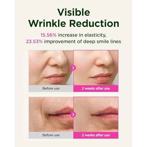 CKD Gua Sha Face Serum - Retinol Collagen Lifting Serum for Firming, Tightening, and Instant Face Lifting. Wrinkle Reduction with Massage Roller. Korean Skin Care. 1.35 fl oz