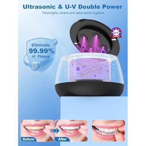 KUNPHY Dental Cleaner | Ultrasonic Retainer Cleaner Machine | 48kHz Dental Cleaning Pod | Aligner, Nightguard, Mouth Guard, Denture | Oral Dental Care | UV Cleaner with Retainer Tablets | Black