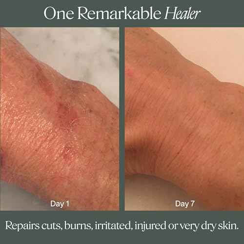 Doctor Rogers Restore Healing Balm. Multi-Purpose Healing Ointment & Moisturizing Eczema Relief Gel. Protects & Soothes Injured, Sensitive & Dry Skin. 4 Ounce (114 g) Tube