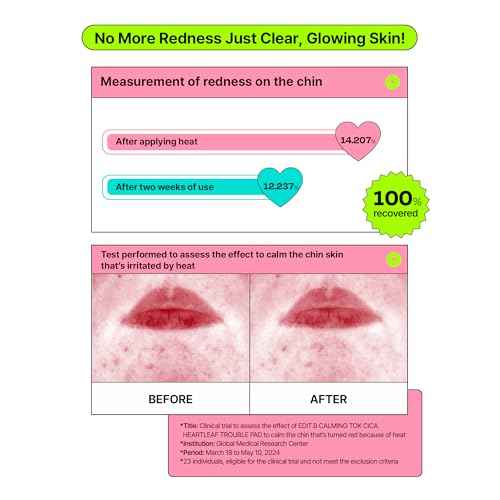 Calming Tok Cica Heartleaf Trouble Pads, Cooling & Hydrating Facial Toner Pads for Sensitive Skin, Mild Exfoliating & Soothing, Easy-Split for Multi-Use, Daily Korean Skin Care (70 Sheets)