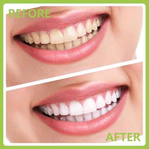 8 Pack Dental Tools PARYUNGR Teeth Cleaning Tool Kit, Stainless Steel Scraper Plaque Tartar Remover Tooth Cleaner Dental Floss Picks, Professional Oral Care Hygiene Set for Personal Pet Use with Case