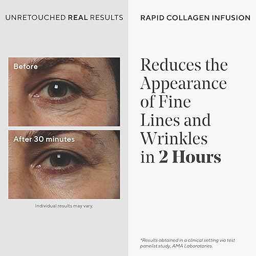 Murad Rapid Collagen Infusion ? Anti-Aging Serum with Collagen Amino Acids & Winged Kelp Extract for Visible Wrinkle Reduction, Enhanced Skin Firmness & Re-Volumizes Skin ? 1.0 Fl Oz
