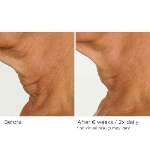 NassifMD Deco-Lift Neck Firming Complex Serum
