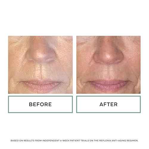 Replenix Anti-Aging Retinol Regenerate Dry Serum, Medical-Grade Quick-Drying Face Serum for Mature Skin (1 fl. oz)