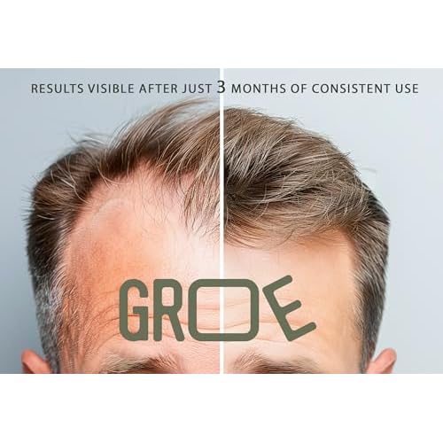 GROE ROSEMARY Anti-Thinning Biotin Hair Growth Shampoo (16.6oz) Natural & Vegan, Sulfate-Free, CLINICALLY TESTED Effective Results, Women & Men