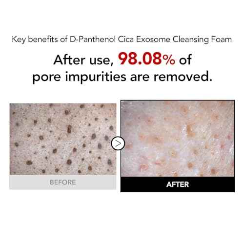 98% Reduction in Pore Impurities & 92% Less Sebum ? Improves Blackheads & Whiteheads by 36% ? Soothes & Strengthens Skin Barrier with D-Panthenol ? Korean Skincare Best Cleansing Foam