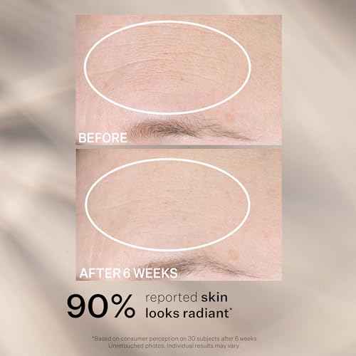 StriVectin Multi-Action Super-C Vitamin C Moisturizer, Brightening and Smoothing Fine Lines, 1.7 Fl Oz