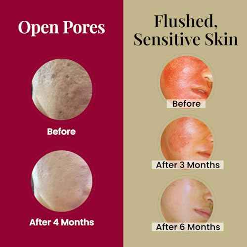 LABO Nutrition Le Revital Concentrated Nano Placenta Extract Serum Essence from Japan ? Hydrating, Glowy, Moisturizing for Face Wrinkles, Dull Skin, Tone, Soothing & Skin Barrier Strength | 4 Vials