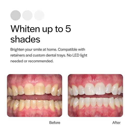 Opalescence 35% CP Mint - Gel Syringes Teeth Whitening - Refill Kit (4 Syringes) Carbamide Peroxide Gel. Made by Ultradent. Tooth Whitening Refill Syringes with Toothbrush. 5197-2tb