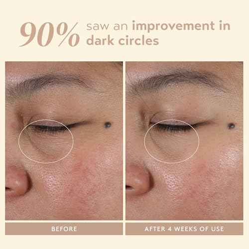 SHANI DARDEN Intensive Eye Renewal Cream, Hydrating Under Eye Cream for Dark Circles, Fine Lines, Wrinkles & Crows Feet with Niacinamide, Shea Butter & Ceramide, Crease-Free & Makeup-Ready, 0.50 fl oz