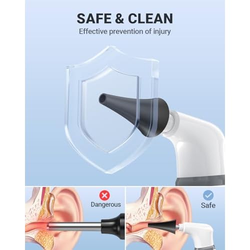 Wireless Otoscope with Gyroscope, Ear Camera with Dual View, 3.9 mm Otoscope with Light, Ear Scope with Ear Wax Removal Tool for Kids, Adults, and Pets, Compatible with iPhone and Android
