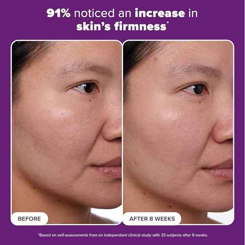 Paula's Choice CLINICAL 1% Retinol Face Moisturizer Treatment with Peptides, Vitamin C & Licorice Extract, Firming Face Cream, Anti-Aging & Wrinkles, Fragrance Free