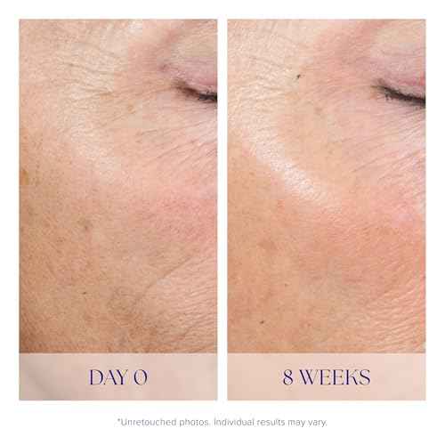 iS CLINICAL Active Peel System, two-step gentle at-home peel system for face Exfoliation