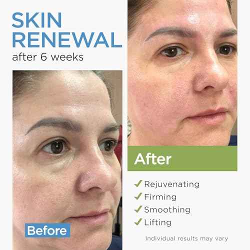 Collagen Face Cream with Stem Cells Retinol Hyaluronic Acid Niacinamide for All Skin Types - Anti-Aging Face Moisturizer with Airless Pump - Day & Night Cream for Wrinkles - Made in USA 1.7 Oz