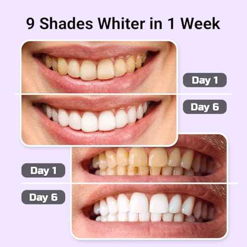 Teeth Whitening Kit ? LED Light & Whitening Gel with Remineralization Syringes ? Professional-Grade Whitening for Sensitive Teeth ? Removes Stains from Coffee, Wine, & Smoking