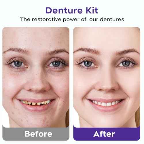 DIY Denture Kit - Full Set Fake Teeth for Top & Bottom | Functional Homemade Denture Combo, Repair Missing Teeth, Create Perfect Smile at Home - CS0725-3