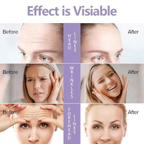 Forehead Wrinkle Patches, Silicone Neck Chest D?collet? Pads, Reusable Medical Grade Anti Wrinkle Patches, Overnight Wrinkle Remover Treatment, Anti Aging Fine Line Smoothing Pads for Women, 6 Pack