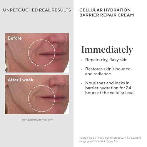 Murad Cellular Hydration Barrier Repair Cream ? Face Moisturizer with Bilberry, Omega Fatty Acids, and Soothing Allantoin for Dry Flaky Skin, Restoring Bounce, Smoothness and Radiance ? 1.7 Fl Oz